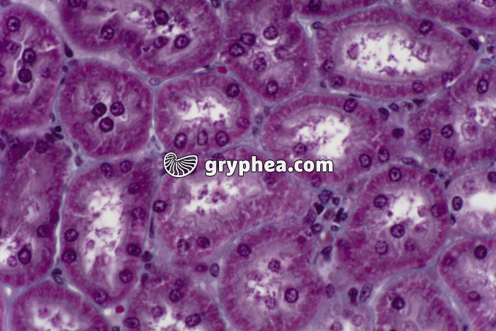 Rein tubules urinaires CT x200 - gryphea.com